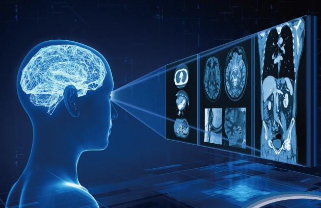  പക്ഷാഘാത ചികിത്സയിൽ നിർണ്ണായകമായി ആർട്ടിഫിഷ്യൽ ഇന്റലിജൻസ്; പുനരാവർത്തന സാധ്യത കുറയുന്നതായി പഠനം